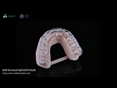 Splint dental occlusal 3D stampato per bruxismo