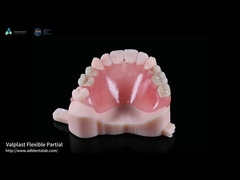Aspetto naturale Valplast protesi parziale Longevità Altamente resistente alle fratture