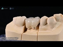 Colore naturale dei denti Veneer ceramico feldspatico per denti anteriori e posteriori