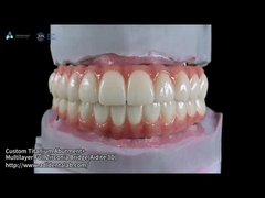 Traslucido Ponte di zirconia a contorno completo su barra di impianto fresata Disegno personalizzato