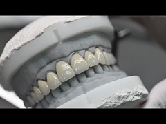 Traslucidità CAD EMAX Veneer lucidato vetrata ceramica restauri per le aree anteriori posteriori