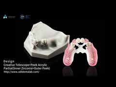 Biocompatibilità Telescopio dentale Bianco Zirconia interna Telescopio esterno Dental
