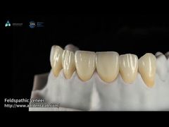 Presenta impiallacciature in ceramica feldspatica EMAX da 0,3 mm-0,7 mm per te Impiallacciature dentali estetiche naturali Emax