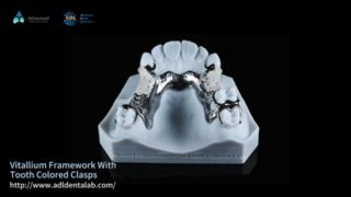 Vitallium Framework Estetica Naturale Easy Fit