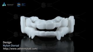 Smetti di digrignare i denti con le protezioni notturne dorsali in nylon personalizzate