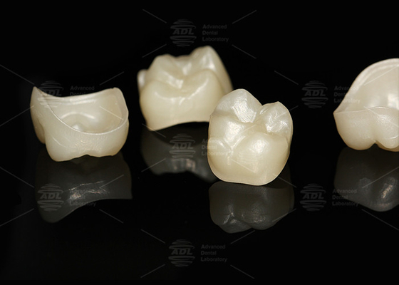 comprare Corone di zirconia naturale a contorno completo, corrispondente al laboratorio dentale a contorno completo fabbricazione online