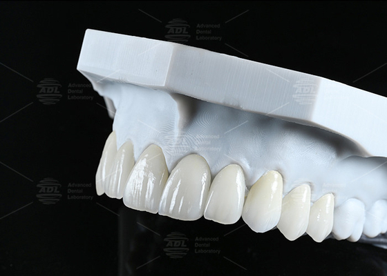 comprare Traslucidità CAD EMAX Veneer lucidato vetrata ceramica restauri per le aree anteriori posteriori fabbricazione online