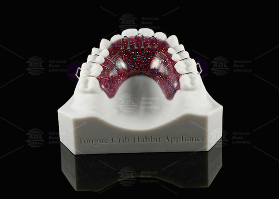 comprare Apparecchio di culla per la lingua ortodontica Habbit Apparecchio di culla per denti personalizzabile fabbricazione online