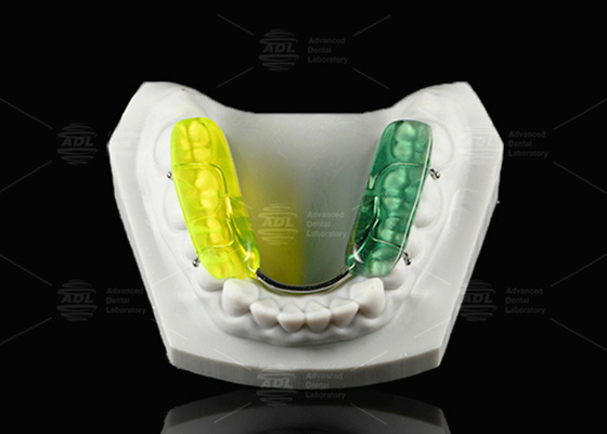 comprare Splinte dentale Gelb colorata Resina acrilica dura Splinte occlusale per la strofinatura notturna dei denti fabbricazione online