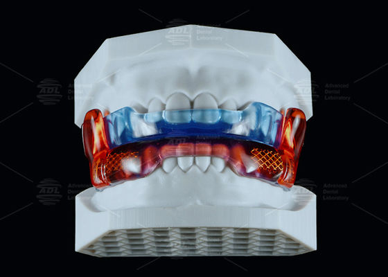 comprare Apparecchio anti russare in silicone di grado medico RP per migliorare il sonno fabbricazione online