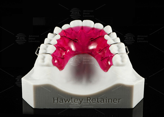 comprare Confortevole supporto in acrilico in acciaio inossidabile Hawley Soluzione ortodontica efficace fabbricazione online