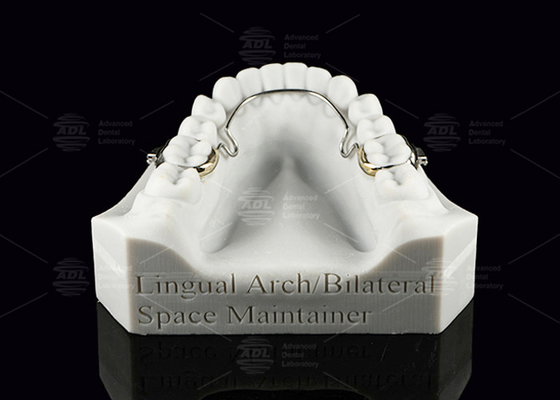 comprare Arco linguale mantenitore di spazio bilaterale denti in acciaio inossidabile mantenitori di spazio fabbricazione online