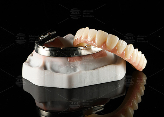 comprare Traslucido Ponte di zirconia a contorno completo su barra di impianto fresata Disegno personalizzato fabbricazione online