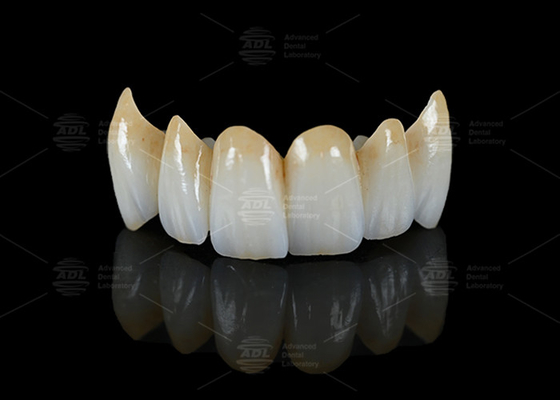 comprare Alta traslucidità di contorno completo Ponte di zirconio Resistenza agli frantumi Estetica naturale fabbricazione online