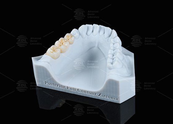 comprare Traslucidità Bianco Conto completo Corona di zirconio FCZ Corona monolitica di zirconio Facile fresatura fabbricazione online