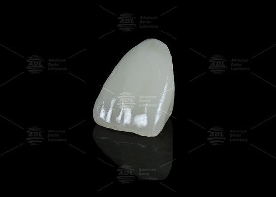 comprare Laboratorio dentale cinese ibrido in ceramica Vita Enamic Dental con traslucidità per restauri di denti singoli fabbricazione online