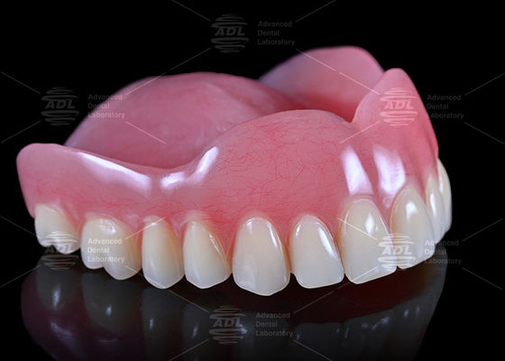 comprare Laboratorio dentale cinese alta estetica personalizzata protesi dentali acriliche complete servizio completo per il mondo intero fabbricazione online
