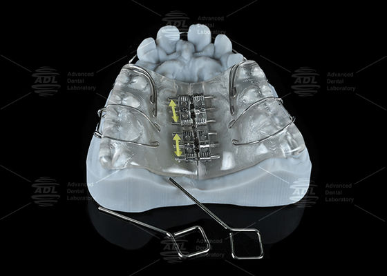 comprare Espansore a vite colorato in acciaio inossidabile per laboratorio odontotecnico per espansione mascellare e mandibolare fabbricazione online