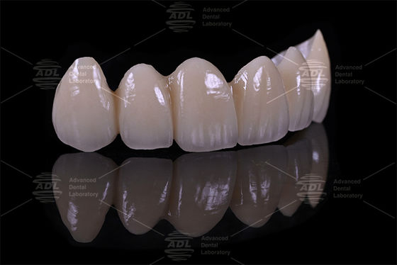 comprare Top 5 fornitori di laboratori dentali cinesi di porcellana fusa a zirconia che garantisce tempi di consegna in 72 ore di servizio per studi e laboratori dentali fabbricazione online