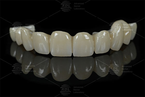 comprare Laboratorio dentale cinese di restauro dentale completo in zirconia Laboratorio dentale specializzato in materiali AIDITE ZIRCONIA BLOCK per soluzioni dentali durevoli fabbricazione online