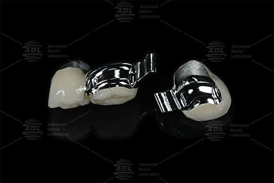 comprare Laboratorio Dental Chino Accesorio de Precisión con Ranura Específica para el Paciente Ajustable para PFM fabbricazione online