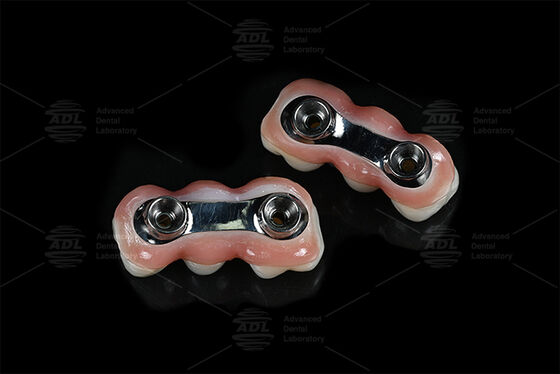 comprare Bar di impianto di rinforzo CAD CAM progettato per l'adeguamento di precisione Compatibile con la maggior parte dei sistemi di impianti dentali Garantendo soluzioni di restauro dentale Laboratorio dentale cinese fabbricazione online