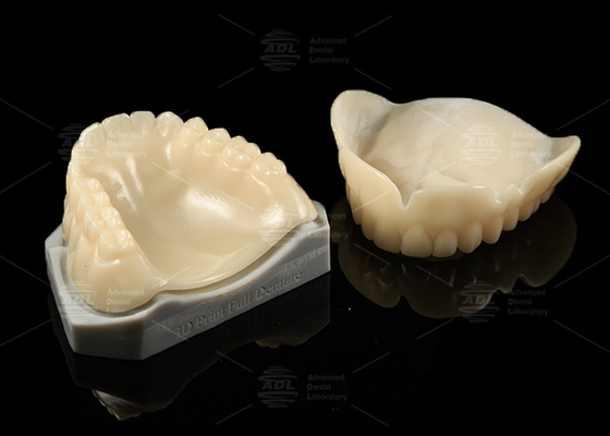 Dentiere stampate in 3D provate in Bio Compatibile A1/A2/A3 Perfetto adattamento e oclusione