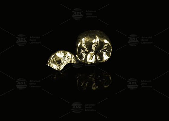 Preziosa lega Oro giallo 60% Corona piena di metallo Finitura corona completa di metallo