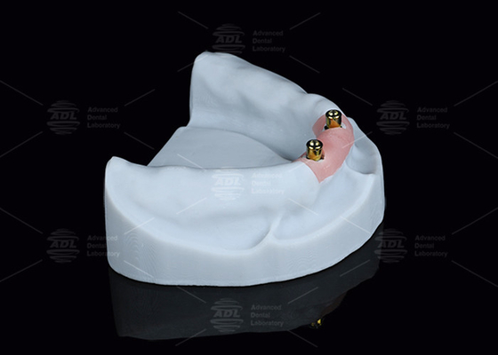 Titanio Locator Dental Attachments per Overdentures in finitura argento e oro