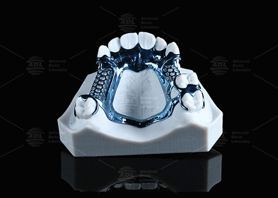 Cornice di titanio stampata in 3D anodizzata leggera e adatta alla pelle sensibile