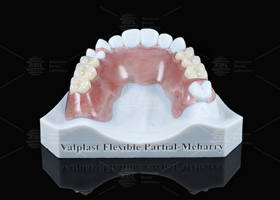 Valplast leggero parziale flessibile con eccellente ritenzione in rosa e marrone