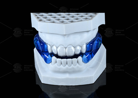 Confortevole Moses Anti Snarking Guard Soft Stop Snarking Boccale