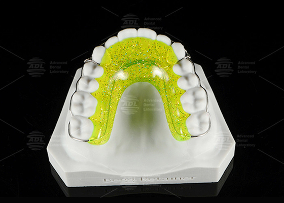 BEGGS RETENER ortodontico per l'allineamento dei denti facile da pulire