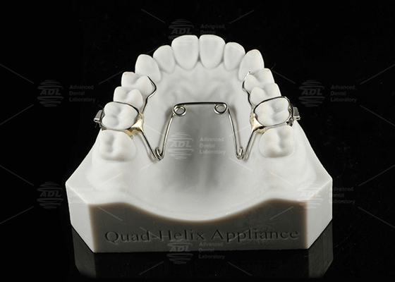 Bambini e adolescenti Quad Helix Appliance Ortodonzia Acciaio inossidabile