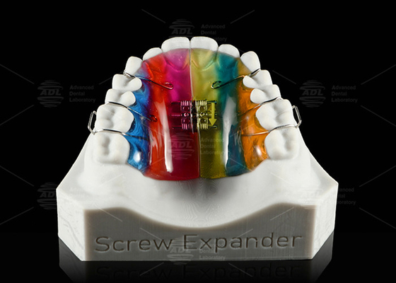 Espansione dei denti e distalizzazione del palato Espansione ortodontica Espansione