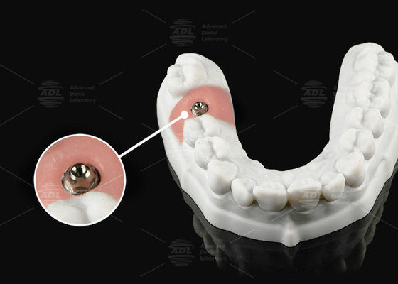 Abutment multiunitario in titanio in oro argento per piattaforme protesiche singole o multiunitarie