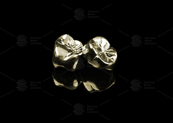 Elegante corona di metallo fuso preziosa lega d'oro 20% lucidato corona dentale di metallo pieno