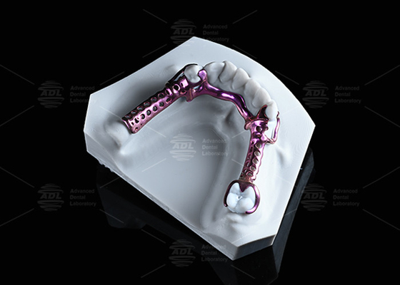 Fabbricazione in titanio 3D anodizzato, resistente, leggera e regolabile