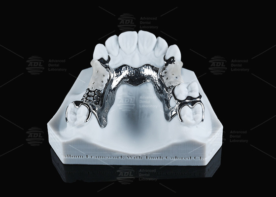 FDA Vitallium Framework con tasti di colore dentale per estetica naturale