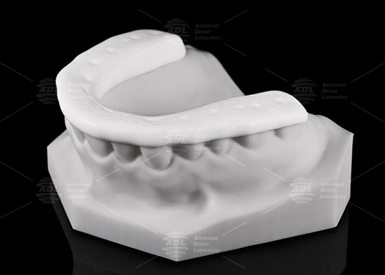 Durabilità e traspirabilità 3D Stampato Nylon Occlusal Splint / Night Guard per stili di vita attivi