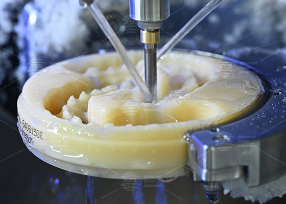 Scopri il potere della protesi dentale estetica e naturale per un sorriso perfetto