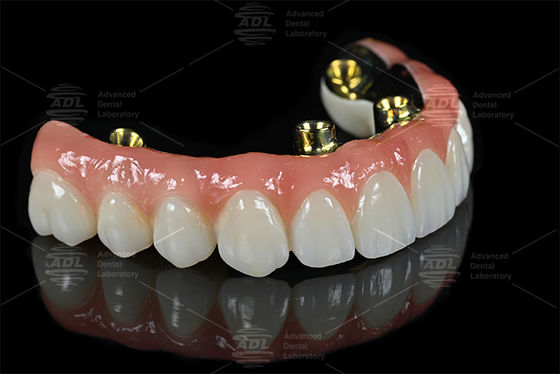 Servizi di outsourcing di laboratori odontotecnici professionali che forniscono protesi dentali accurate e soluzioni personalizzate per le esigenze del settore dentale