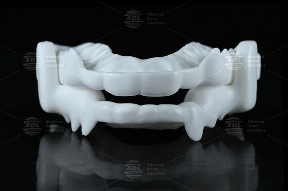 Stecca occlusale in nylon di grado medicale per bruxismo con design CAD/CAM flessibile per protezione notturna